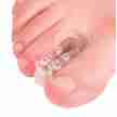 Techdance TH-167 hallux valgus scheider 